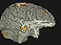 Brains039WorryCentre039Investigated