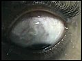 eyeballvideo