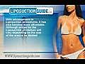 LiposuctionCost