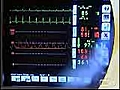 TherapeuticDrugMonitoringandPersonalizedMedicineRosaFYeh