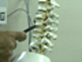 LatestTreatmentsforOsteoporosis