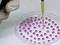 StemCellsforParkinsonsDisease