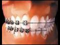 Ortodontiktedavigrenkisineleredikkatetmeli