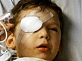 SurgeonOperatesonWrongEyeof4YearOldBoy