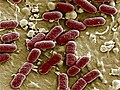 DeadlyEcoliisnewstrainofbacteria