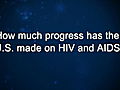 CuriosityCalvinButtsProgressAgainstHIVandAIDS