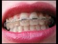 Ortodontiaciverenbirtedaviyntemimi
