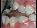 Ortodontiktedavilerpahalimidir