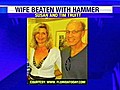 DoctorChargedWithBeatingWifeWithHammer