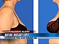 BotoxBreastLift